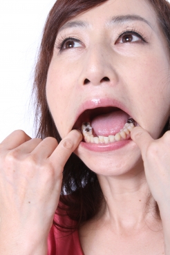 湯川美智子さんの歯！