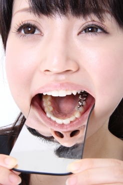 相沢レオナちゃんの歯