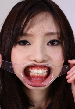 莉子チャン　きれいな歯ですね～