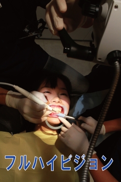 フルハイビジョン【歯科医師治療映像】年齢の割りに大量の歯石がこびりついたフリーターの歯石除去治療【特選画像53枚付】