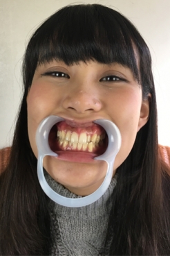 篠岬ことみちゃんの歯観察＆歯磨き